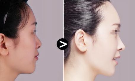 鄭州雙眼皮醫(yī)院綜合排行榜揭曉！權(quán)威榜單揭示雙眼皮醫(yī)療技術(shù)的精髓