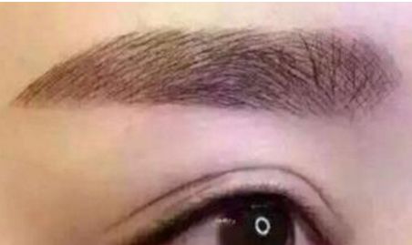 九院瞬間靚眼，告別上眼瞼下垂困擾，醫(yī)術(shù)專業(yè)獨具慧眼！