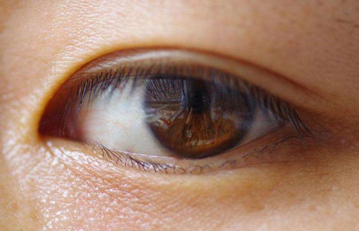 美域高醫(yī)療為您展示全新隆鼻案例，賦予您完美鼻型！