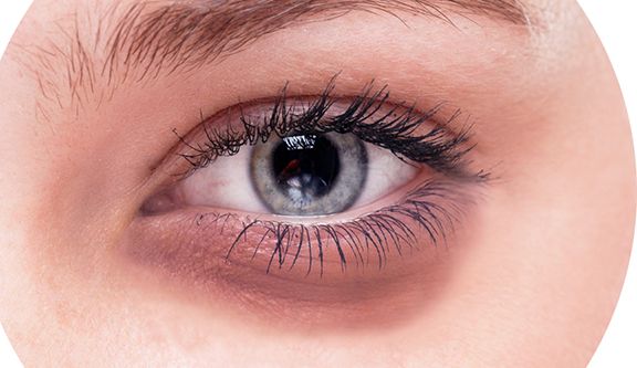 2023年北京最佳點(diǎn)痣醫(yī)院及祛斑費(fèi)用查詢