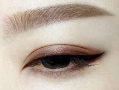 成都美萊雷狀醫(yī)生2023年隆鼻案例揭示：美貌與自然魅力統(tǒng)一修復