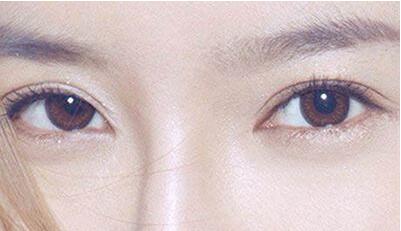 2023河北滄州整形醫(yī)院匯總前五結(jié)果，哪家靜港、水芙蓉、京美更可靠？