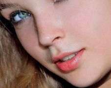 郭波雙眼皮手術(shù)效果如何？90天后恢復情況揭示