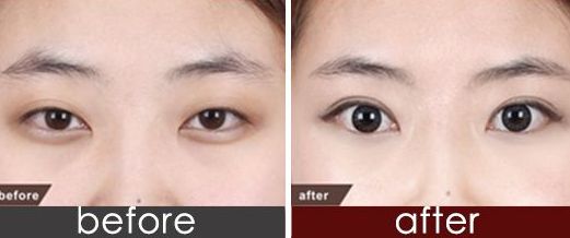 上海市九院品牌種植牙醫(yī)生推薦！頂尖口腔權(quán)威專家聯(lián)合推薦，價格一覽！