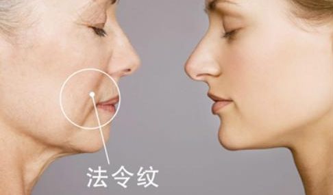 武漢雙眼皮醫(yī)生哪些技術(shù)強？陳宏案例揭秘前五強！