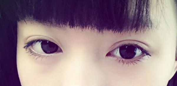 靠前重慶眼部整形醫(yī)院榜單出爐，時(shí)光整形受認(rèn)可