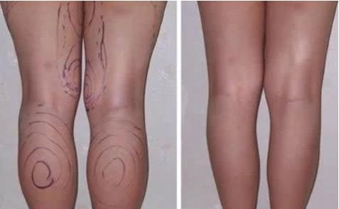 廣東省整形醫(yī)院新聲，權(quán)威排名榜單曝光