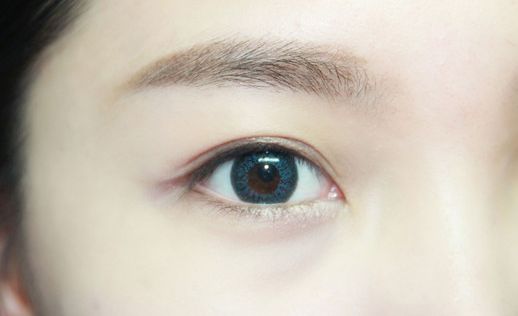 北京雙眼皮手術(shù)，專業(yè)醫(yī)院推薦