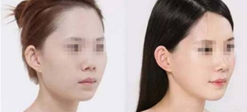 揭秘北京醫(yī)美界領(lǐng)先的8家私立吸脂手術(shù)醫(yī)院