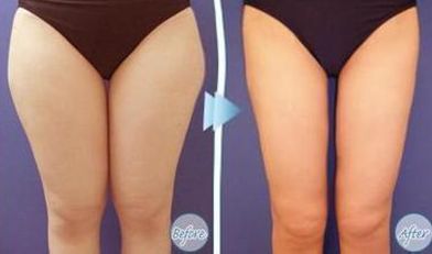 杭州痤瘡修復(fù)?？漆t(yī)院推薦