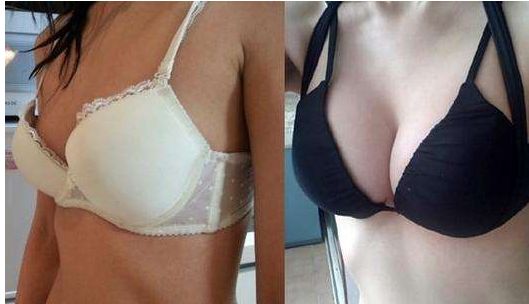 長沙雙眼皮手術(shù)：田芳斌與解燦哪位醫(yī)生更優(yōu)秀？前五專家詳細介紹！有必要留存~