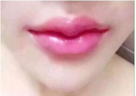 有哪些北京玻尿酸醫(yī)院值得推薦？這是前五家醫(yī)院強(qiáng)烈推薦的！