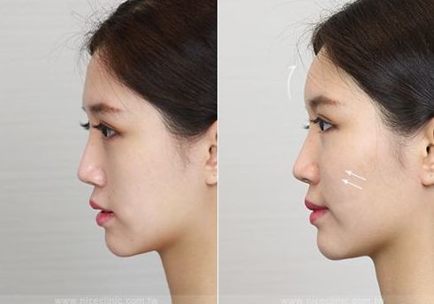 上海九院哪位醫(yī)生在人氣專家榜單上表現(xiàn)出色，值得面部提升患者青睞？