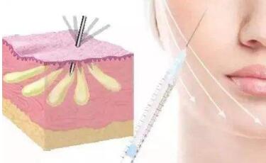 武漢仁愛時光吸脂手術(shù)優(yōu)質(zhì)可靠嗎？它有哪些優(yōu)點(diǎn)？