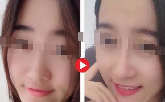 【2024年】蘇州哪家整形醫(yī)院口碑最好？評選出的前三強(qiáng)！