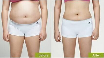 廣州雙眼皮整形醫(yī)院排名前十榜單已定！難道紫馨和軍美是口碑比較好的選擇？