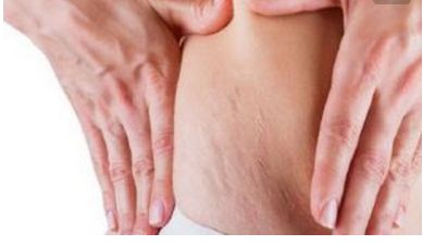 重慶亞美醫(yī)院楊武林醫(yī)生的眼部手術效果如何？