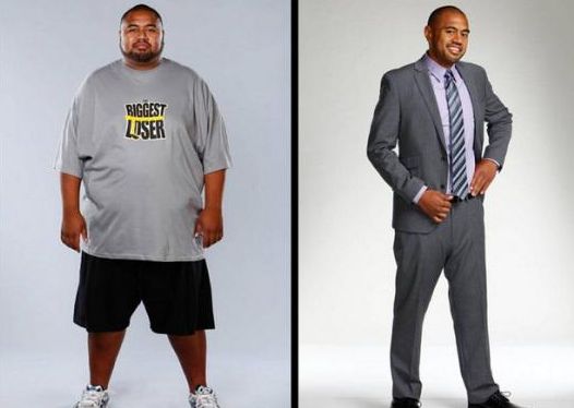 上海九院激光脫毛價(jià)格資訊，推薦專家選擇