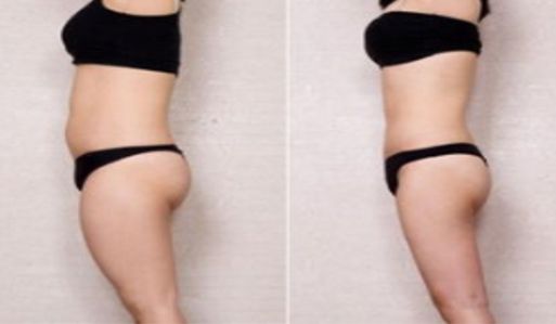 深圳最新刷新！這些除皺醫(yī)院排行榜上名列前茅！