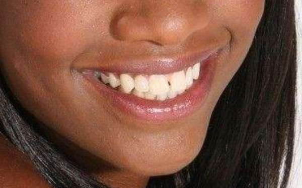 2023年河南哪家醫(yī)院手術(shù)消除動(dòng)態(tài)細(xì)紋效果更佳？全新美容醫(yī)院排行榜曝光！