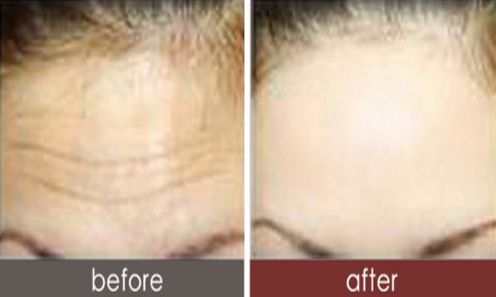 深圳整形科優(yōu)秀的頂級醫(yī)院有哪些？2023年醫(yī)院名單提前曝光！