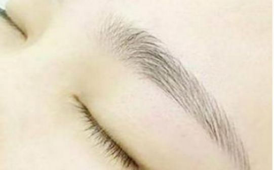 樂山市人民醫(yī)院中瞇眼袋手術(shù)談何效果？眼袋修復(fù)專家醫(yī)師及成功案例分享