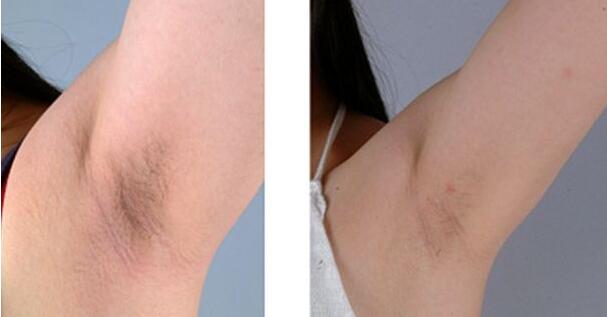 2023長春市中心醫(yī)院整形外科價格如何？【宋彬】醫(yī)生經(jīng)驗(yàn)分享真可信嗎？