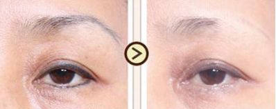 西安熱瑪吉醫(yī)療名列榜首！細(xì)數(shù)醫(yī)院，專(zhuān)業(yè)洞察與好評(píng)傳開(kāi)