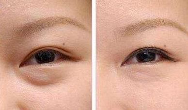 上海九院種植牙醫(yī)生推薦：這幾位牙醫(yī)技術(shù)獨(dú)特，深受患者好評(píng)！