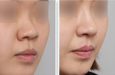 杭州最受歡迎的胸部整容整形醫(yī)院排行榜揭曉，網(wǎng)友推薦眾多醫(yī)院，有沒(méi)有熟悉的？