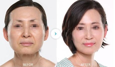 南寧整形醫(yī)院排行榜大揭秘，找準專業(yè)的整形醫(yī)院才能保證安全與效果