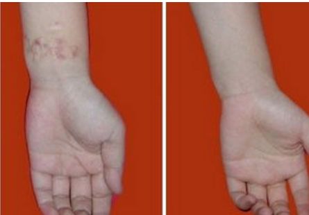 深圳龍華地區(qū)熱門整形醫(yī)院排名公開！