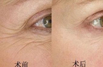 南京鳳凰島整形外科門診部的王科醫(yī)生口碑如何？聯(lián)合李敏醫(yī)生介紹及手術(shù)后的反饋，揭秘這位醫(yī)生的實力！