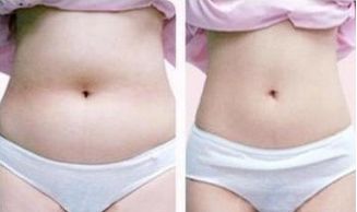 華西整形美容科報價目錄及專家優(yōu)勢評測