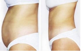 解決眼袋問題的四川整形醫(yī)院推薦