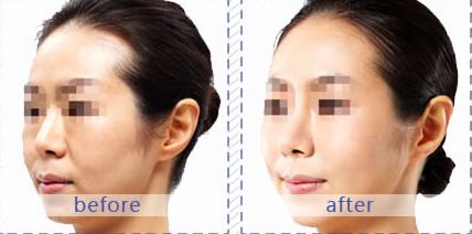 成都哪家醫(yī)院適合皮膚美容？