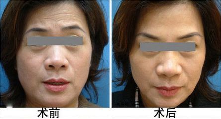 廣安阿藍(lán)醫(yī)院整形科評(píng)價(jià)，是否正規(guī)？地址詳細(xì)一覽