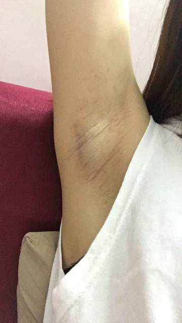 上海健橋植發(fā)技術(shù)實力如何？頭發(fā)再生效果值得期待嗎？