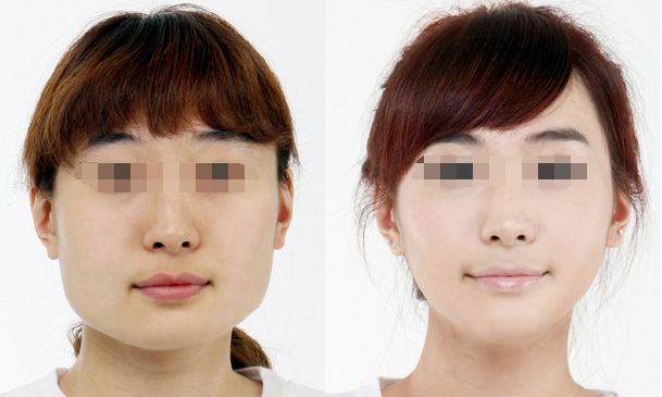 蘇州吸脂手術(shù)哪家醫(yī)院好？匯總七大優(yōu)質(zhì)醫(yī)療機構(gòu)