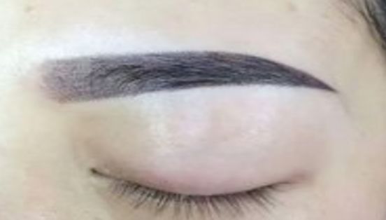 大連微整形醫(yī)院，注重玻尿酸填充技術優(yōu)勢