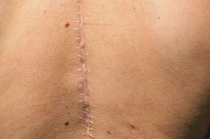 廣州龍城區(qū)手術(shù)神醫(yī)排行榜，醫(yī)術(shù)高超的拉皮專家一覽