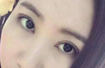 上海華東醫(yī)院整形外科主任醫(yī)師榜單揭曉！先進(jìn)隆鼻療法案例分享及費(fèi)用明細(xì)，急需閱讀！