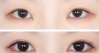 廣州韓后許滿萍醫(yī)生的專業(yè)領(lǐng)域揭秘，令人驚喜的嫩膚案例分享