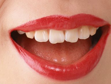 北京301醫(yī)院雷永紅如何進行雙眼皮手術(shù)？真實案例分享