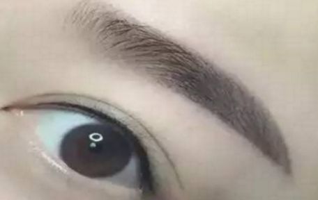 哈爾濱醫(yī)科大學(xué)二院最新整形去痦子技術(shù)揭秘，讓肌膚恢復(fù)純凈光潔