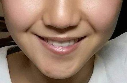 東方和諧醫(yī)療美容吸脂醫(yī)生名單曝光！專家推薦，值得關(guān)注