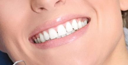 西京醫(yī)院鼻部整形丨馬顯杰教授，項(xiàng)目介紹與真人案例圖解析