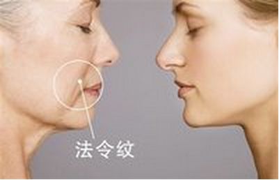 美麗改變，趙德星鼻子整形前后對比，驚艷有度！