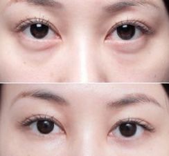 上海美萊醫(yī)院的療效一流，備受好評的醫(yī)生大揭秘！