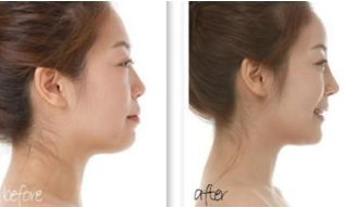 上海美容醫(yī)生脂肪填充技術(shù)出類拔萃！最強大腦層出不窮！